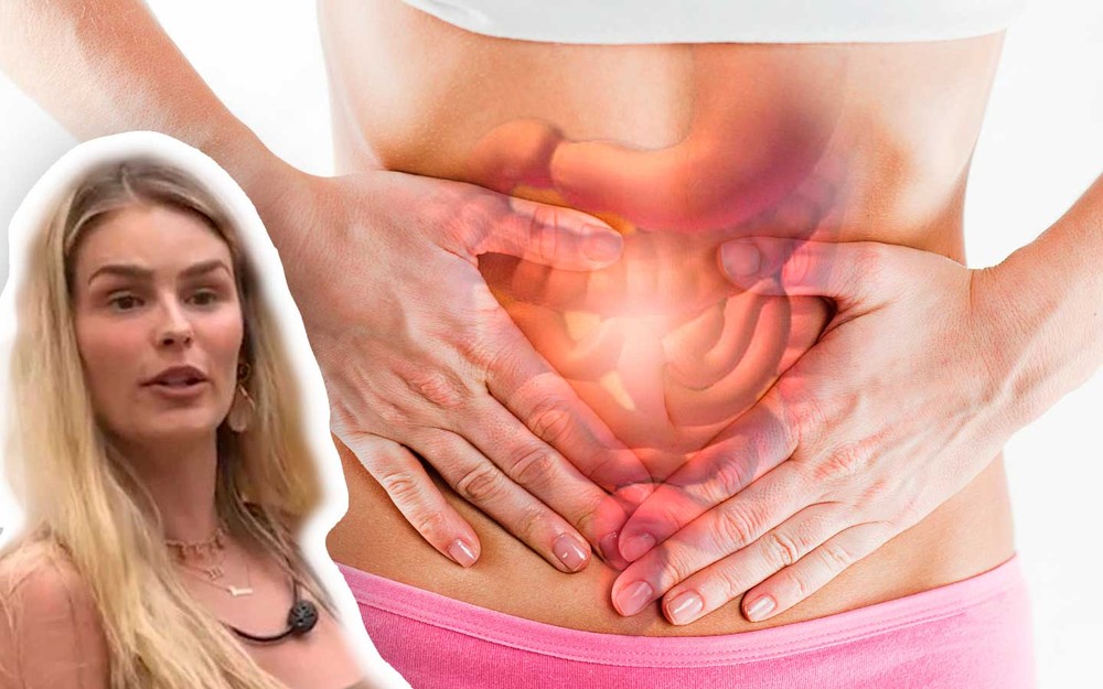 Síndrome do intestino irritável: entenda o que é a condição que Yasmin Brunet, do BBB 24, diz ter
